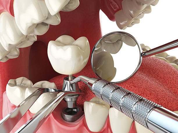 Best Cracked Tooth Emergency Dentist  in Maryvle, IL